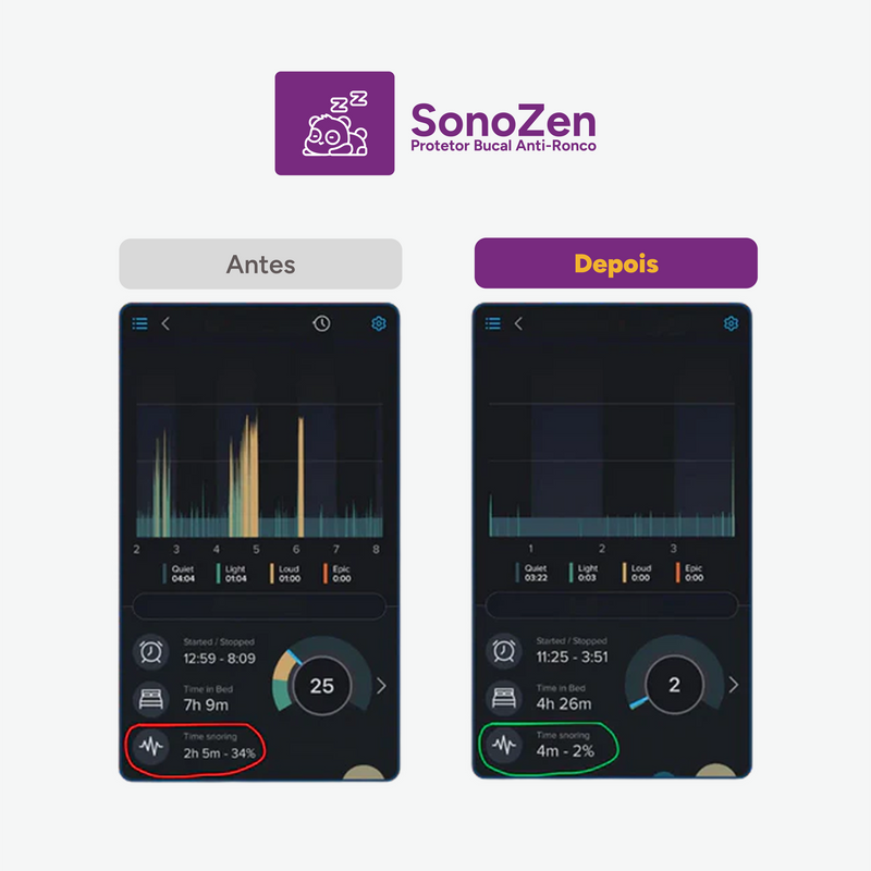 Protetor Bucal Anti-Ronco SonoZen® - [ Últimas Unidades com Desconto ]